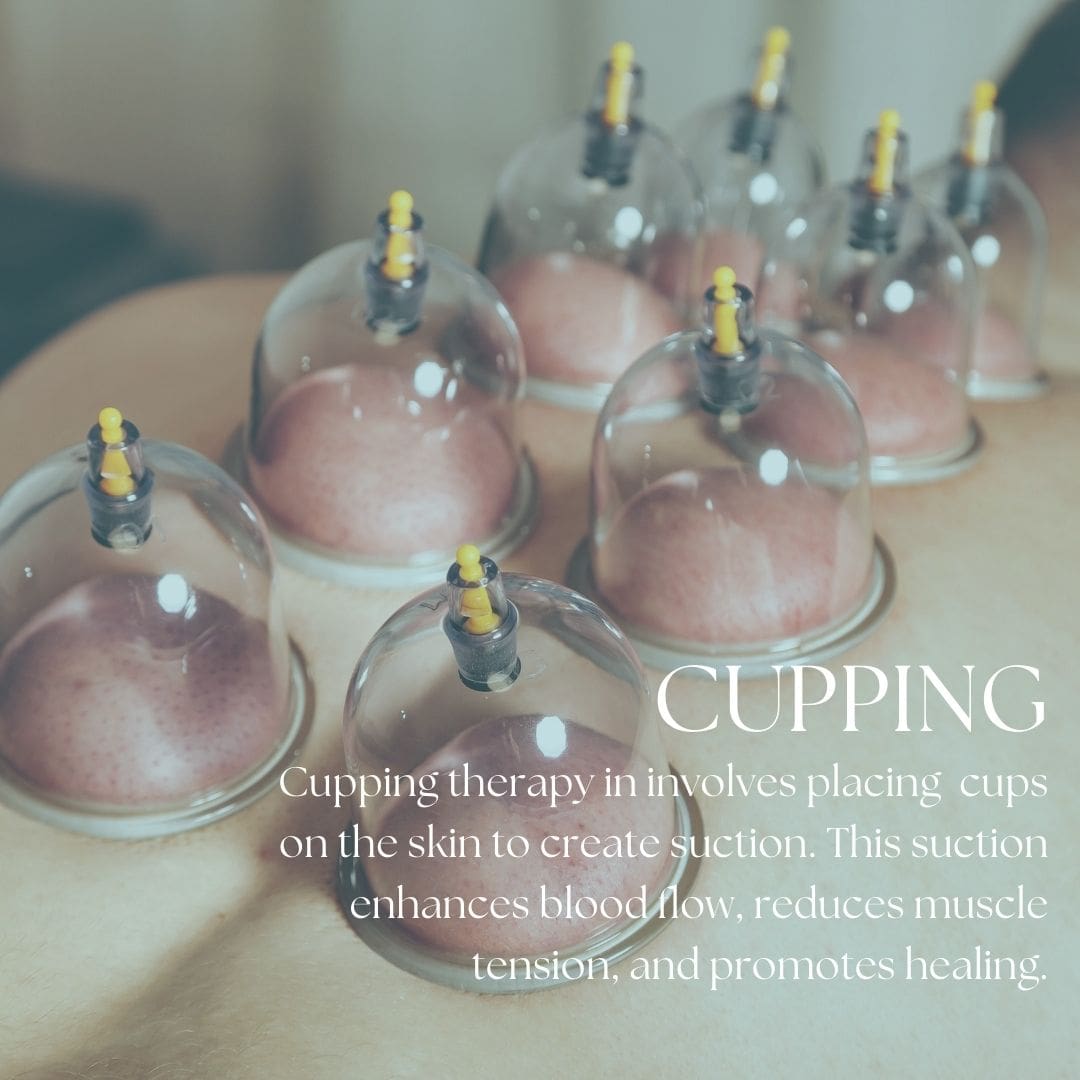 Services Cupping